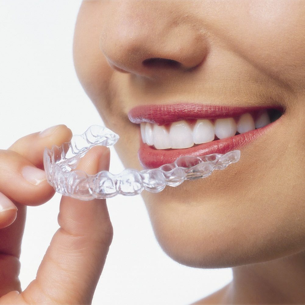 exploits valley services invisalign background image
