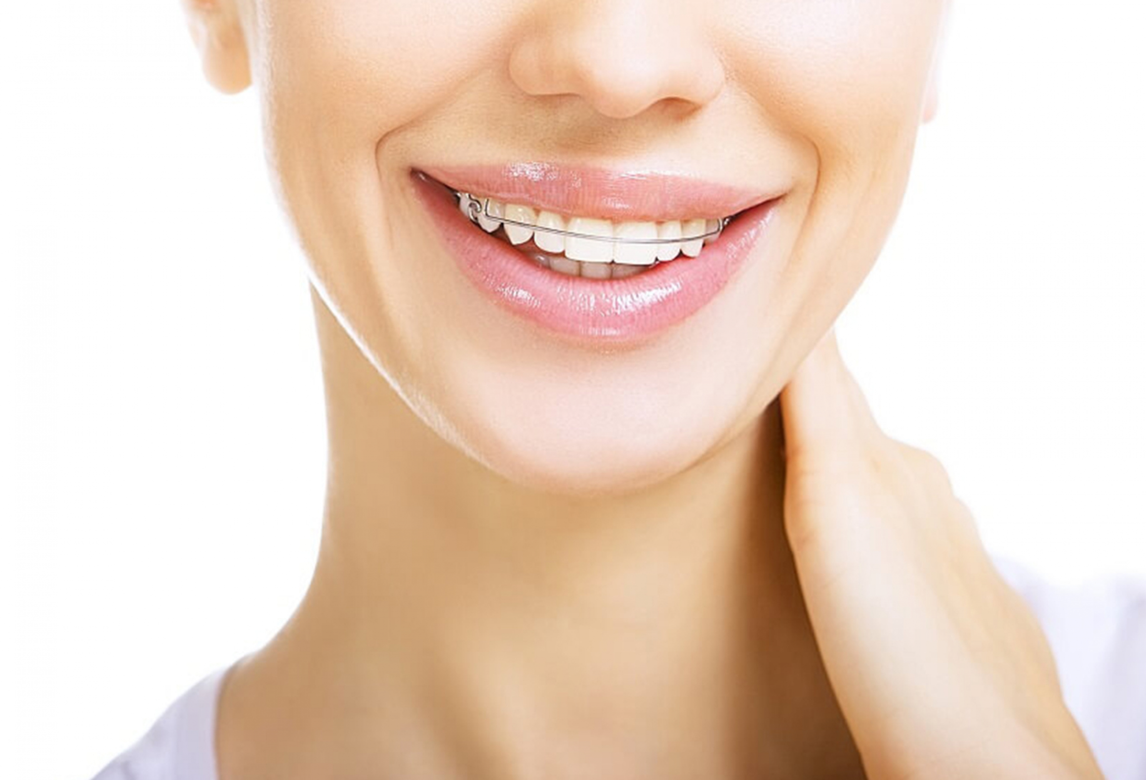 What Happens After Braces Treatment? Exploits Valley