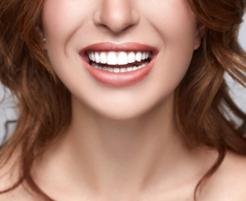 What is a ‘Snap-On Smile’?